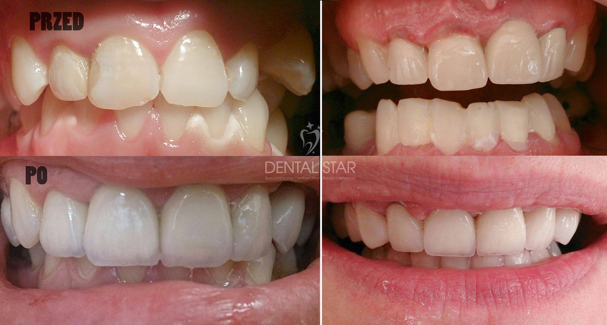 Dental Star - Metamorfozy "Przed i po" nr 1